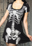 Black fit and flare dress with white skeleton torso print, photographed on a model in front of a metal gate background.